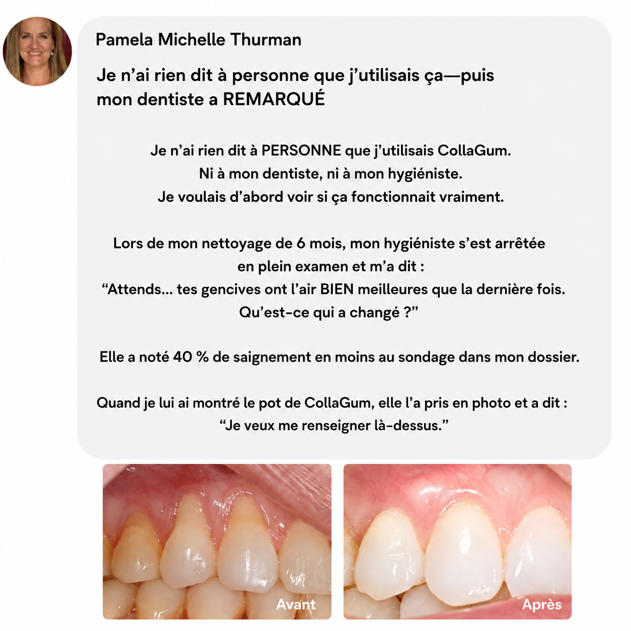 CollaGum™