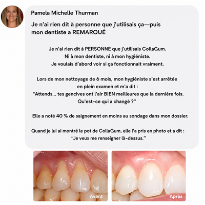 CollaGum™
