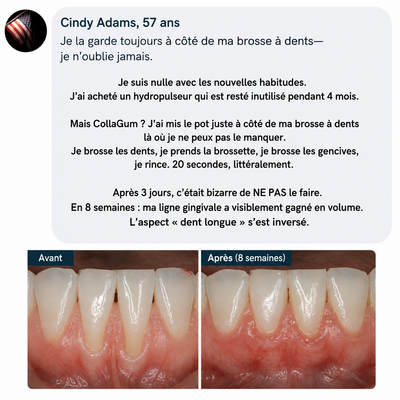 CollaGum™