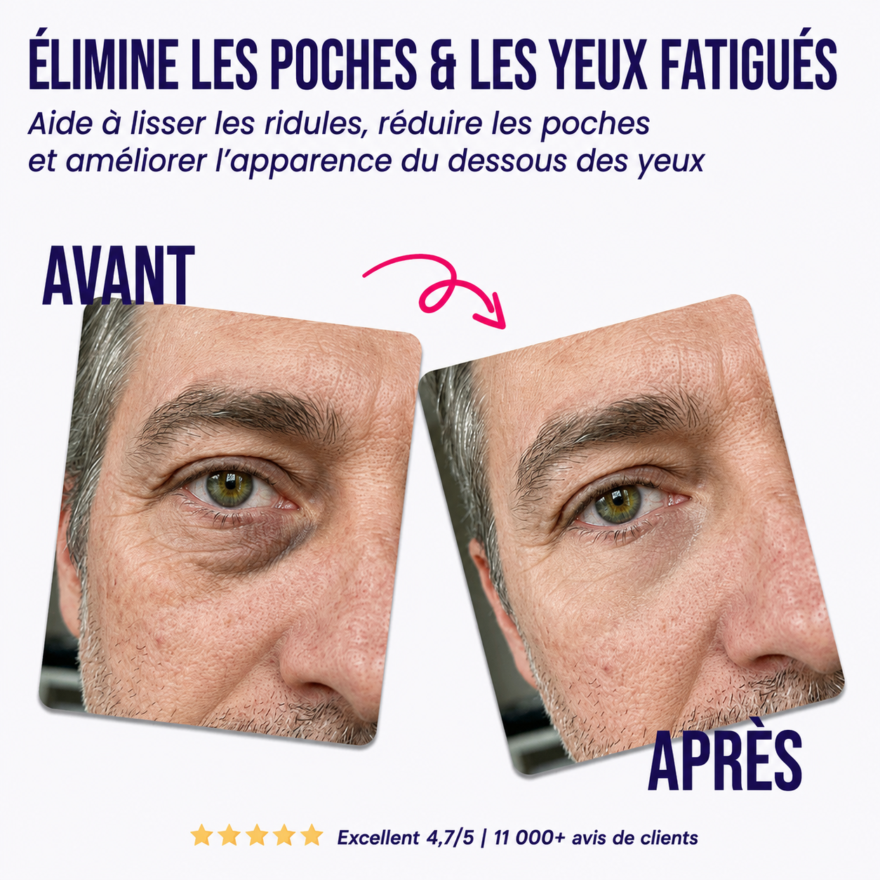 Reinvital : Patchs Réparateurs Contour des Yeux