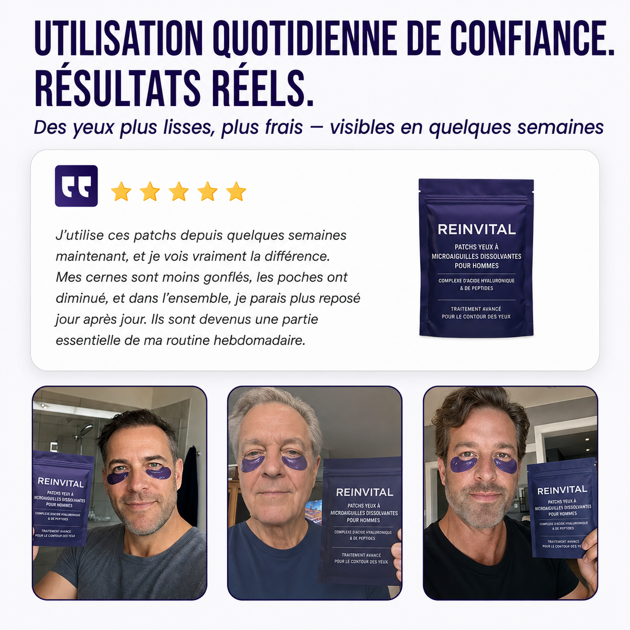 Reinvital : Patchs Réparateurs Contour des Yeux